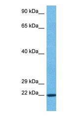 Western blot of THOC7 Antibody with human 721_B Whole Cell lysate.