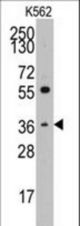 Western blot of anti-THPO antibody in K562 cell line lysates (35 ug/lane). THPO(arrow) was detected using the purified antibody.