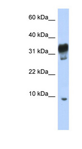 PXT1 antibody LS-C102665 Western blot of Jurkat lysate.