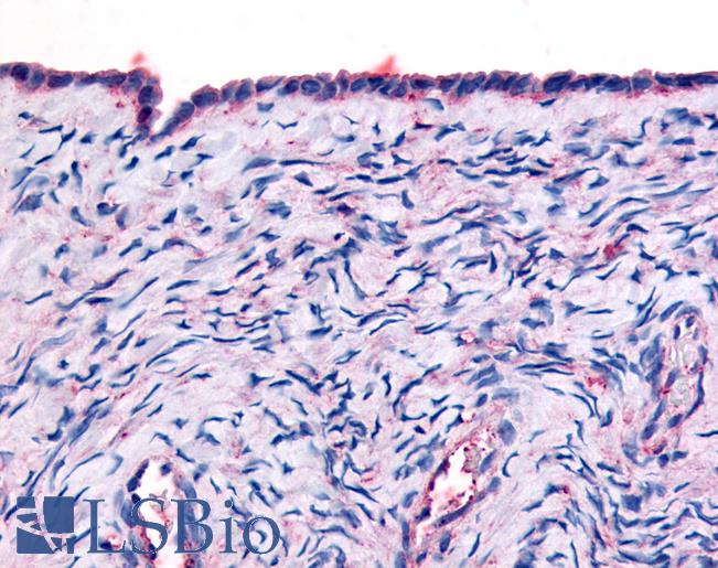 Anti-THRA antibody LS-A6196 IHC of human surface epithelium. Immunohistochemistry of formalin-fixed, paraffin-embedded tissue after heat-induced antigen retrieval.