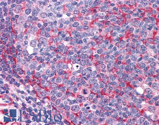 Anti-THRA antibody IHC of human tonsil. Immunohistochemistry of formalin-fixed, paraffin-embedded tissue after heat-induced antigen retrieval. Antibody LS-B4351 concentration 3.75 ug/ml.