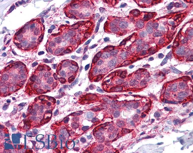 Anti-THRA antibody IHC of human breast. Immunohistochemistry of formalin-fixed, paraffin-embedded tissue after heat-induced antigen retrieval. Antibody LS-B4351 concentration 3.75 ug/ml.