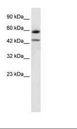Jurkat Cell Lysate