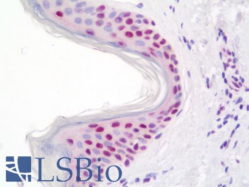 Anti-THRAP3 / TRAP150 antibody IHC staining of human skin. Immunohistochemistry of formalin-fixed, paraffin-embedded tissue after heat-induced antigen retrieval.