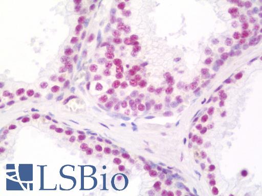 Anti-THRAP3 / TRAP150 antibody IHC staining of human prostate. Immunohistochemistry of formalin-fixed, paraffin-embedded tissue after heat-induced antigen retrieval. Antibody LS-B11040 dilution 1:100.