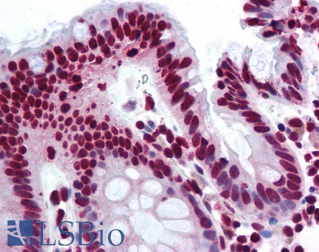 Anti-THRAP3 antibody IHC of human colon. Immunohistochemistry of formalin-fixed, paraffin-embedded tissue after heat-induced antigen retrieval. Antibody LS-B1795 concentration 10 ug/ml.