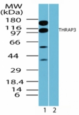 Western blot of human Thyroid hormone receptor associated protein 3 in HeLa cell lysate in the 1) absence and 2) presence of immunizing peptide using antibody at 0.1 ug/ml.