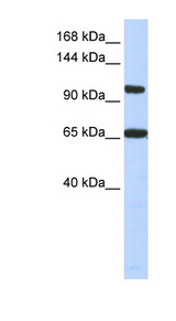 THRAP3 antibody LS-C110290 Western blot of Fetal Muscle lysate.