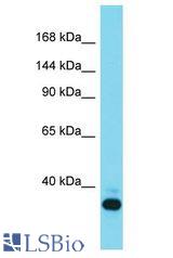 THRAP3 / TRAP150 antibody Western Blot of Mouse Liver. Antibody dilution: 1 ug/ml.