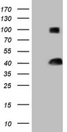 HEK293T cells were transfected with the pCMV6-ENTRY control (Left lane) or pCMV6-ENTRY THTPA (Right lane) cDNA for 48 hrs and lysed. Equivalent amounts of cell lysates (5 ug per lane) were separated by SDS-PAGE and immunoblotted with anti-THTPA (1:2000).