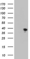 HEK293T cells were transfected with the pCMV6-ENTRY control (Left lane) or pCMV6-ENTRY THTPA (Right lane) cDNA for 48 hrs and lysed. Equivalent amounts of cell lysates (5 ug per lane) were separated by SDS-PAGE and immunoblotted with anti-THTPA.