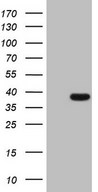 HEK293T cells were transfected with the pCMV6-ENTRY control (Left lane) or pCMV6-ENTRY THTPA (Right lane) cDNA for 48 hrs and lysed. Equivalent amounts of cell lysates (5 ug per lane) were separated by SDS-PAGE and immunoblotted with anti-THTPA.