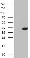HEK293T cells were transfected with the pCMV6-ENTRY control (Left lane) or pCMV6-ENTRY THTPA (Right lane) cDNA for 48 hrs and lysed. Equivalent amounts of cell lysates (5 ug per lane) were separated by SDS-PAGE and immunoblotted with anti-THTPA.
