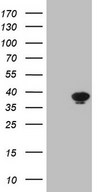 HEK293T cells were transfected with the pCMV6-ENTRY control (Left lane) or pCMV6-ENTRY THTPA (Right lane) cDNA for 48 hrs and lysed. Equivalent amounts of cell lysates (5 ug per lane) were separated by SDS-PAGE and immunoblotted with anti-THTPA.
