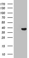 HEK293T cells were transfected with the pCMV6-ENTRY control (Left lane) or pCMV6-ENTRY THTPA (Right lane) cDNA for 48 hrs and lysed. Equivalent amounts of cell lysates (5 ug per lane) were separated by SDS-PAGE and immunoblotted with anti-THTPA.