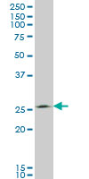 THTPA monoclonal antibody (M01), clone 3F6 Western blot of THTPA expression in A-431.