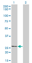 Western blot of THTPA expression in transfected 293T cell line by THTPA monoclonal antibody (M01), clone 3F6.