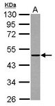 Sample (30 ug of whole cell lysate) A: A431 10% SDS PAGE THUMPD2 antibody diluted at 1:5000