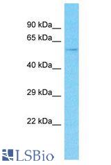THUMPD3 antibody Western Blot of 293T. Antibody dilution: 1 ug/ml.