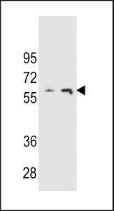 THUM3 Antibody western blot of A2058 and A375 cell line lysates (35 ug/lane). The THUM3 Antibody antibody detected the THUM3 Antibody protein (arrow).