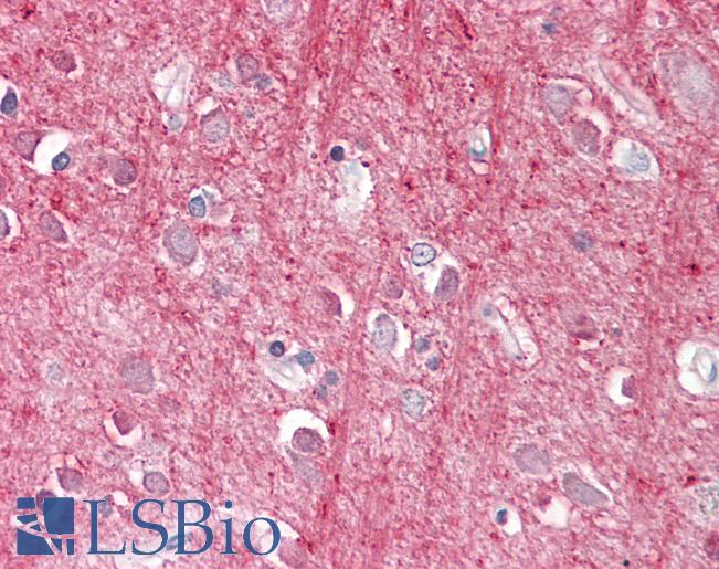 Anti-Thy-1 / CD90 antibody IHC of human brain, cortex. Immunohistochemistry of formalin-fixed, paraffin-embedded tissue after heat-induced antigen retrieval. Antibody LS-B8313 dilution 3.75 ug/ml.