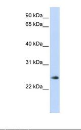 Fetal muscle lysate. Antibody concentration: 1.0 ug/ml. Gel concentration: 12%.