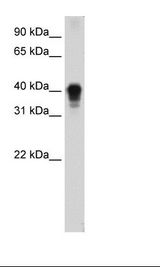 Fetal Thymus Lysate