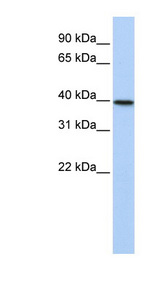 TIA1 antibody LS-C101880 Western blot of 721_B cell lysate.