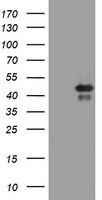 HEK293T cells were transfected with the pCMV6-ENTRY control (Left lane) or pCMV6-ENTRY TIA1 (Right lane) cDNA for 48 hrs and lysed. Equivalent amounts of cell lysates (5 ug per lane) were separated by SDS-PAGE and immunoblotted with anti-TIA1.