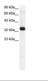 Jurkat Cell Lysate