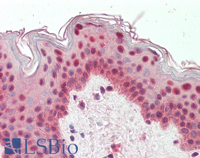 Anti-TIAL1 / TIAR antibody IHC staining of human skin. Immunohistochemistry of formalin-fixed, paraffin-embedded tissue after heat-induced antigen retrieval.