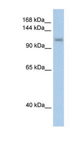 PRPF6 antibody LS-C40319 Western blot of Transfected 293T cell lysate.
