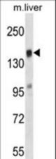 TIAM2 Antibody western blot of mouse liver tissue lysates (35 ug/lane). The TIAM2 antibody detected the TIAM2 protein (arrow).