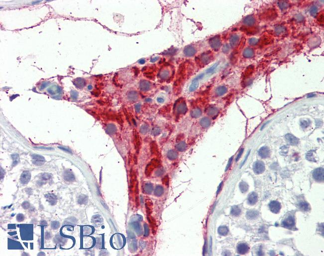 Human, Testis: Formalin-Fixed Paraffin-Embedded (FFPE)
