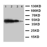 WB of TICAM1 / TRIF antibody. Recombinant Protein Detection Source:. E.coli derived -recombinant Human TICAM1, 44.7KD. (162aa tag+ Q468-E712). Lane 1: Recombinant Human TICAM1 Protein 10ng. Lane 2: Recombinant Human TICAM1 Protein 5ng. Lane 3: Recombinant Human TICAM1 Protein 2.5ng. Lane 4: Recombinant Human TICAM1 Protein 1.25ng.
