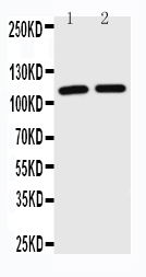 WB of TICAM1 / TRIF antibody. Lane 1: JURKAT Cell Lysate. Lane 2: HL-60 Cell Lysate.