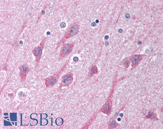 Anti-TICAM1 / TRIF antibody IHC of human brain, cortex. Immunohistochemistry of formalin-fixed, paraffin-embedded tissue after heat-induced antigen retrieval. Antibody LS-B1412 concentration 5 ug/ml.