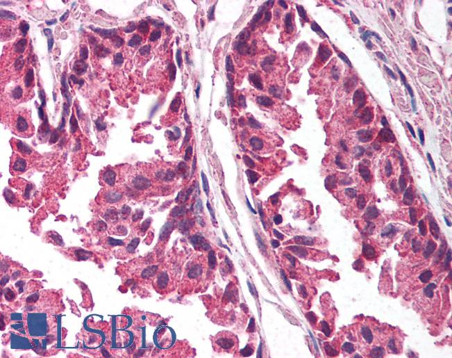 Anti-TICAM1 / TRIF antibody IHC of human prostate. Immunohistochemistry of formalin-fixed, paraffin-embedded tissue after heat-induced antigen retrieval. Antibody LS-B1412 concentration 5 ug/ml.