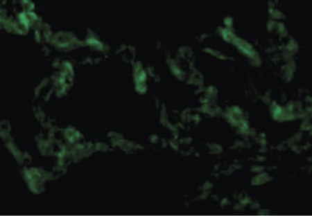 Immunofluorescence of TRIF in Human Lung cells with TRIF antibody at 10 ug/ml.