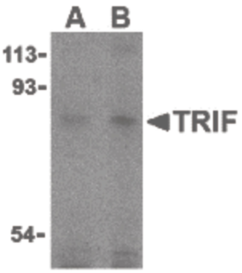 Western blot of TRIF in human lung cell lysates with TRIF antibody at (A) 2 and (B) 4 ug/ml.