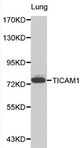 Western blot of TICAM1 pAb in extracts from mouse lung tissue.