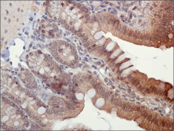 Immunohistochemistry: ASC/TMS1 Antibody - IHC of ASC/TMS1 in mouse intestine using DAB with hematoxylin counterstain.