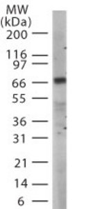 Western blot of TICAM1 in mouse spleen lysate using antibody at 1:1000 dilution.