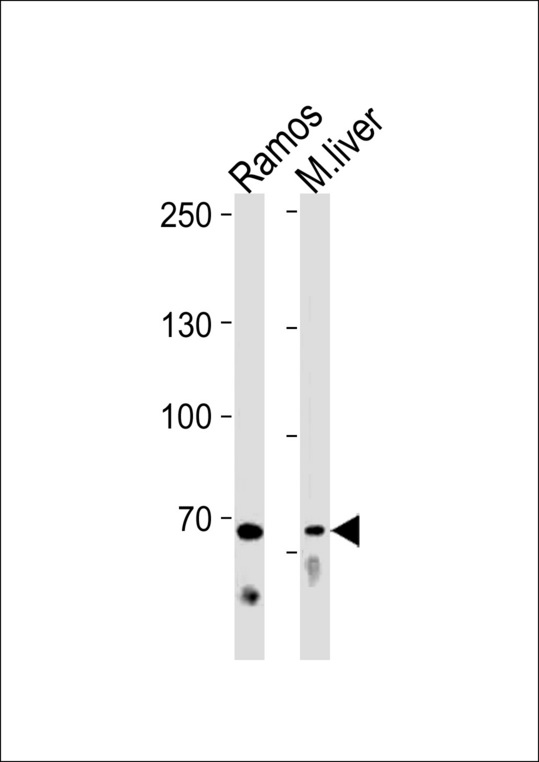 TICAM1 Antibody western blot of Ramos cell line and mouse liver tissue lysates (35 ug/lane). The TICAM1 antibody detected the TICAM1 protein (arrow).