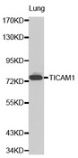 Western blot analysis of lung cell lysate using TICAM1 antibody.