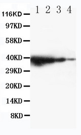 WB of TICAM1 / TRIF antibody. Recombinant Protein Detection Source:. E.coli derived -recombinant Mouse TICAM1,37.5KD. (162aa tag+ L551-E732). Lane 1: Recombinant Mouse TICAM1 Protein 10ng. Lane 2: Recombinant Mouse TICAM1 Protein 5ng. Lane 3: Recombinant Mouse TICAM1 Protein 2.5ng. Lane 4: Recombinant Mouse TICAM1 Protein 1.25ng.