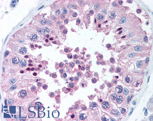 Anti-TICAM1 / TRIF antibody IHC of human testis. Immunohistochemistry of formalin-fixed, paraffin-embedded tissue after heat-induced antigen retrieval. Antibody LS-B632 concentration 5 ug/ml.