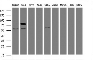 Western blot of extracts (35 ug) from 9 different cell lines by using anti-TICAM1 monoclonal antibody (HepG2: human; HeLa: human; SVT2: mouse; A549: human; COS7: monkey; Jurkat: human; MDCK: canine; PC12: rat; MCF7: human).