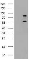 HEK293T cells were transfected with the pCMV6-ENTRY control (Left lane) or pCMV6-ENTRY TICAM1 (Right lane) cDNA for 48 hrs and lysed. Equivalent amounts of cell lysates (5 ug per lane) were separated by SDS-PAGE and immunoblotted with anti-TICAM1.
