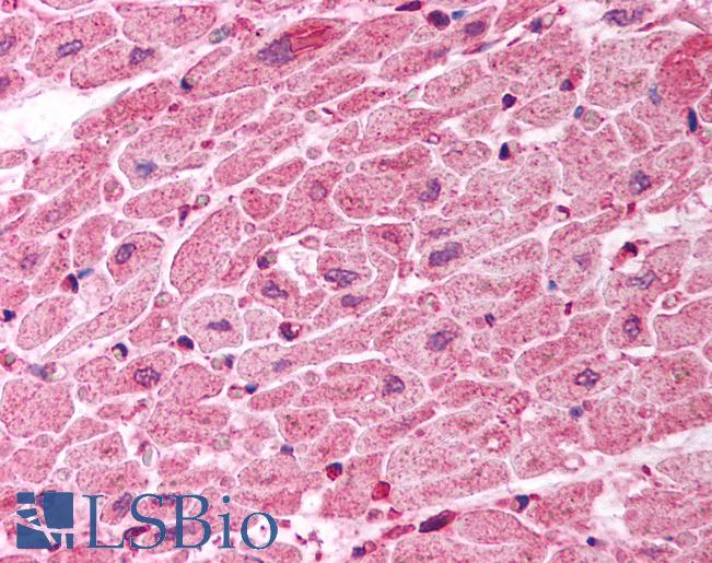 Anti-TICAM1 / TRIF antibody IHC of human heart. Immunohistochemistry of formalin-fixed, paraffin-embedded tissue after heat-induced antigen retrieval. Antibody LS-B754 concentration 10 ug/ml.